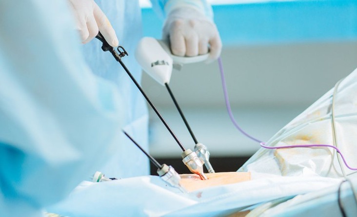 Robotik ve Laparoskopik Cerrahi