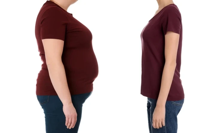 Obezite ve Metabolik Cerrahi